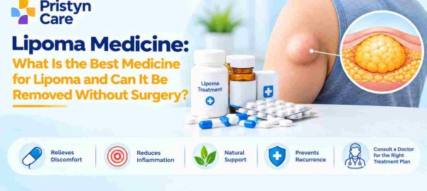Lipoma Medicine: What Is the Best Medicine for Lipoma and Can It Be Removed Without Surgery?