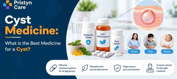 Cyst Medicine: What Is the Best Medicine for a Cyst?