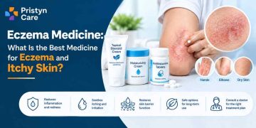 Eczema Medicine