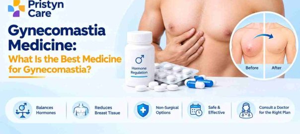 Gynecomastia Medicine: What Is the Best Medicine for Gynecomastia?