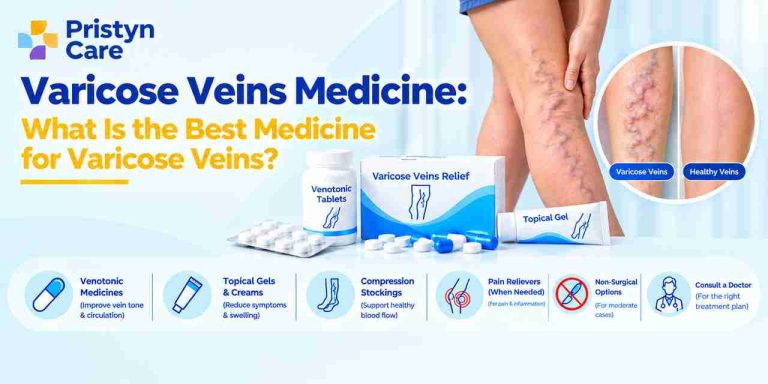 Varicose Veins