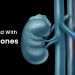foods to avoid in kidney stone