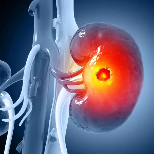 Doctor performing kidney stone surgery