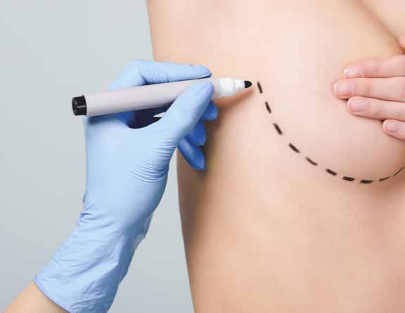Physical examination for Breast Surgery