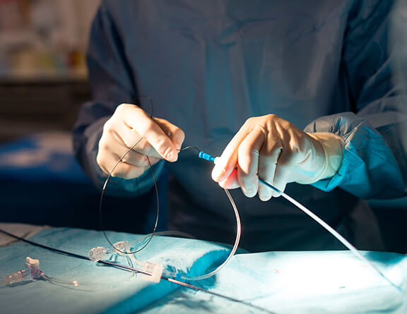 Doctor preparing to perform surgery for deep vein thrombosis