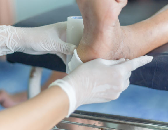 Checking the ankle with infection for confirming Diabetic Foot Ulcers