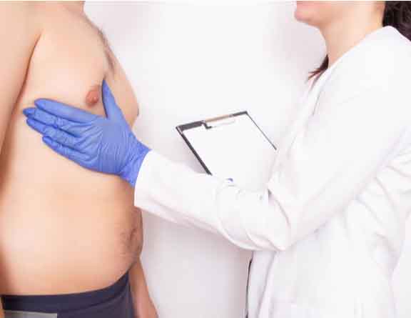 Physical examination for Gynecomastia