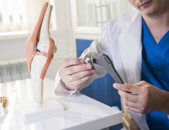 Doctor holding hip replacement implant used in hip replacement