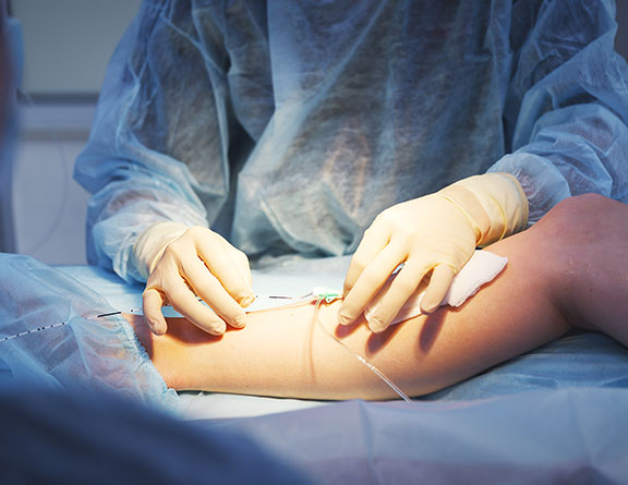 Doctors performing laser surgery for varicose veins