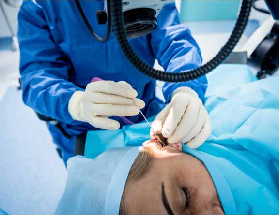 Doctors performing tympanoplasty for perforated eardrum