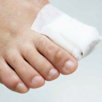 Myths & facts about Diabetic Foot Ulcer 