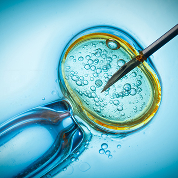 How is IVF done? Step-by-step process of IVF