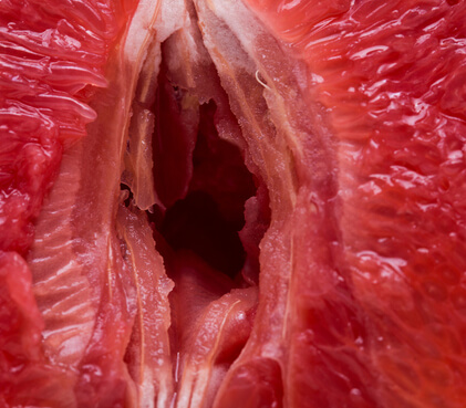 Labiaplasty Formation