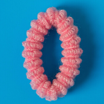 Grade 1: Mild to moderate vaginal loosening