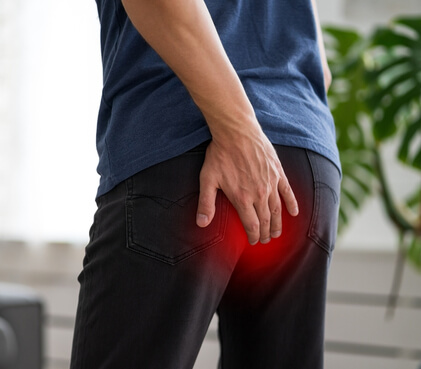 Piles Treatment