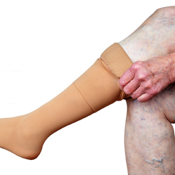 Prevention of varicose veins