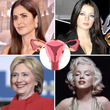 Celebrities with Endometriosis