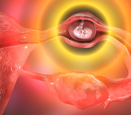 Ectopic Pregnancy Image 