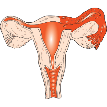 ectopic pregnancy causes