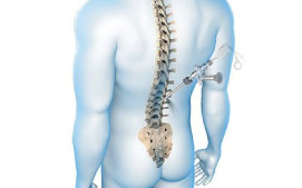 Endoscopic Spine Surgery