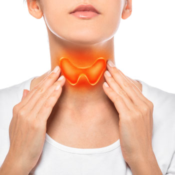 Woman with an enlarged thyroid gland