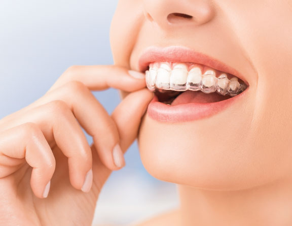 Doctor-performing-Teeth Aligners-surgery-in-Bangalore