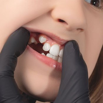 Dental Examination