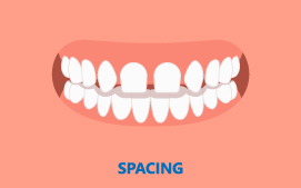 Spacing