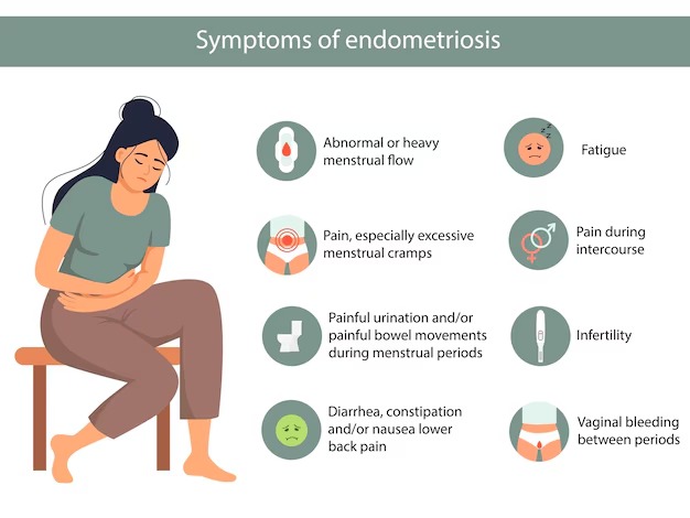 Illustration showing common symptoms of endometriosis, like pelvic pain and heavy periods