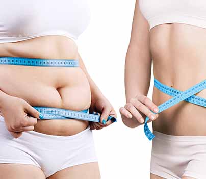 Weight Loss treatment