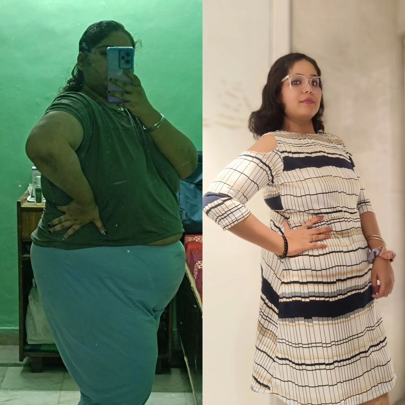 jasleen Kaur Before After bariatric surgery
