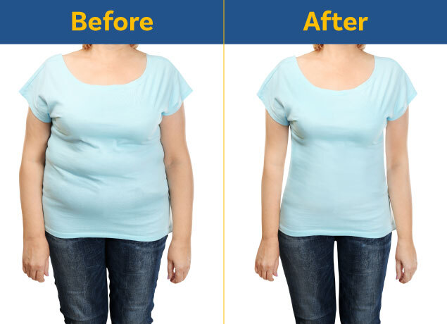 Before & After Weight loss for Female 