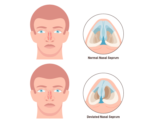 About Treatment