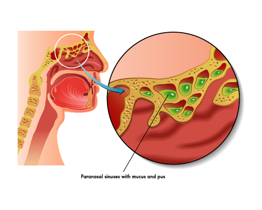 About Treatment