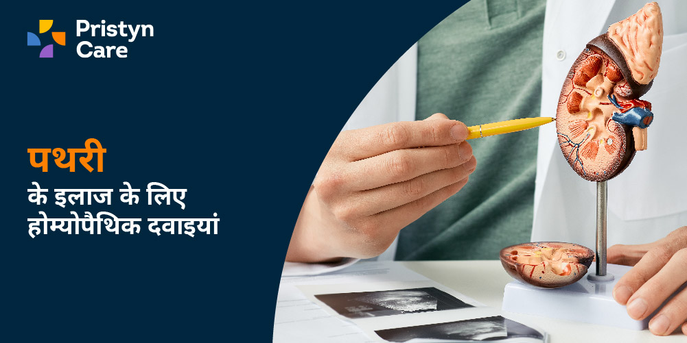 पथरी के इलाज के लिए होम्योपैथिक दवाइयां kidney stone homeopathy treatment