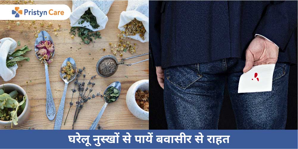 home remedies for piles