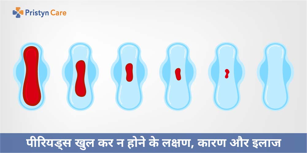 पीरियड खुल कर के आने के लिए क्या करें