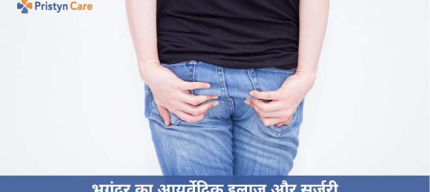 भगंदर का आयुर्वेदिक इलाज और दवा | Ayurvedic Treatment For Fistula In Hindi