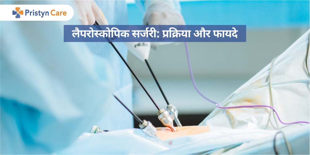 Laparoscopy in Hindi