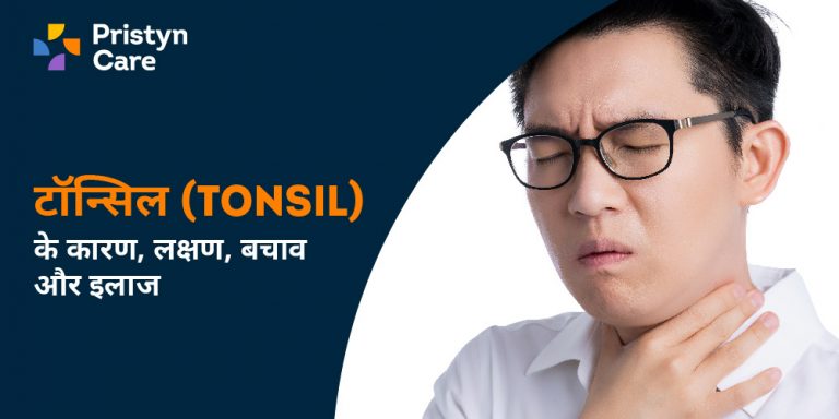 टॉन्सिल (Tonsil) के कारण, लक्षण, बचाव और इलाज - Tonsil Surgery