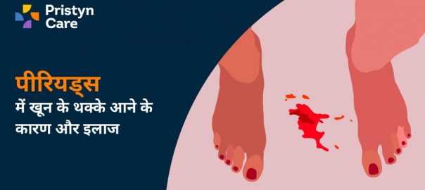 पीरियड्स में खून के थक्के आने के कारण और इलाज (period me blood ka thakka aana)