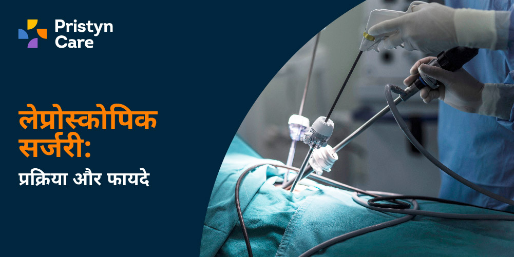 Laparoscopy in Hindi