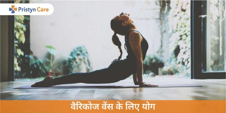 varicose-veins-ke-liye-yoga