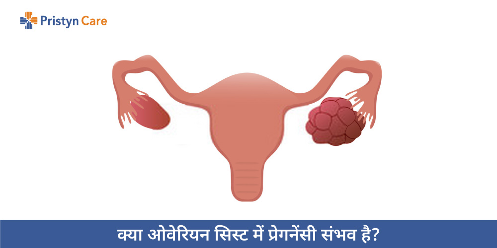 kya-ovarian-cyst-mein-pregnancy-sambhav-hai