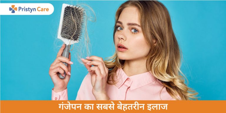 hair-loss-treatment-in-hindi