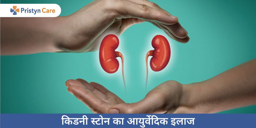 kidney-stone-ka-ayurvedik-ilaj