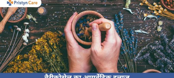 वैरीकोसेल का आयुर्वेदिक इलाज — Varicocele Ka Ayurvedic Ilaj