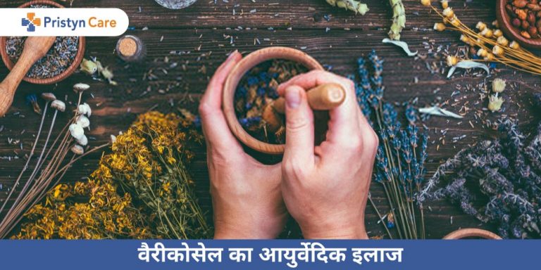 varicocele-ka-ayurvedic-ilaj