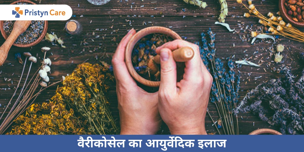 varicocele-ka-ayurvedic-ilaj