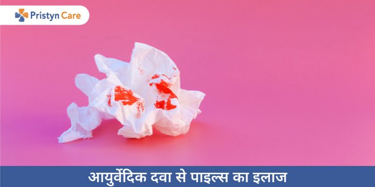 ayurvedic-treatment-of-piles-in-hindi